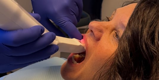 Adult female in a dental chair with a 3D scanner placed in his mouth. They are scanning the area of the tooth that needs a crown.