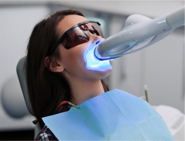 Teeth Whitening